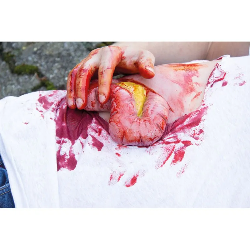 Wound Moulage Protruding of small and large intestines