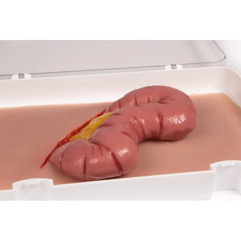 Wound Moulage Protruding of small and large intestines