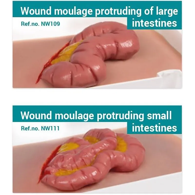 Wound Moulage Protruding of small and large intestines